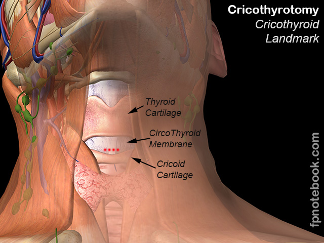 ErProcedureCricothyrotomyLandmarkCricothyroid