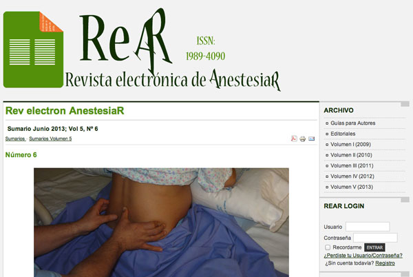 Revista electrónica de AnestesiaR Junio 2013