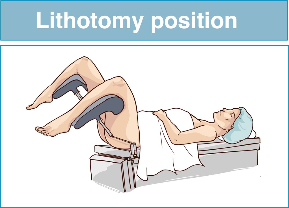 Posición de litotomía