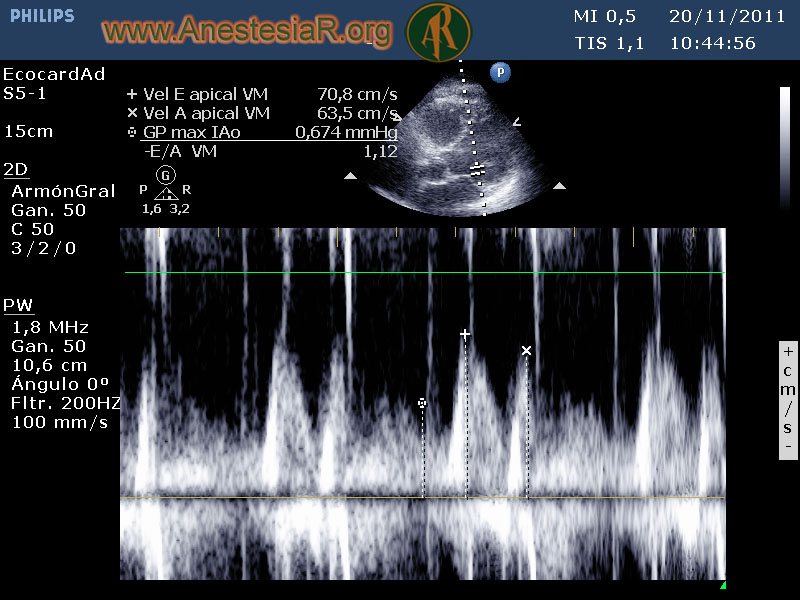 II Curso de Ecografí­a en el Manejo Hemodinámico y Respiratorio del paciente Crí­tico y de Quirófano