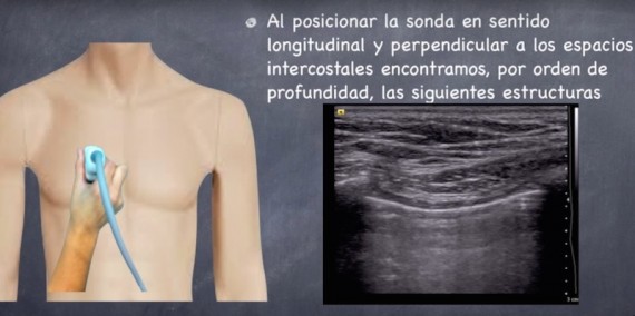 eco pulmonar
