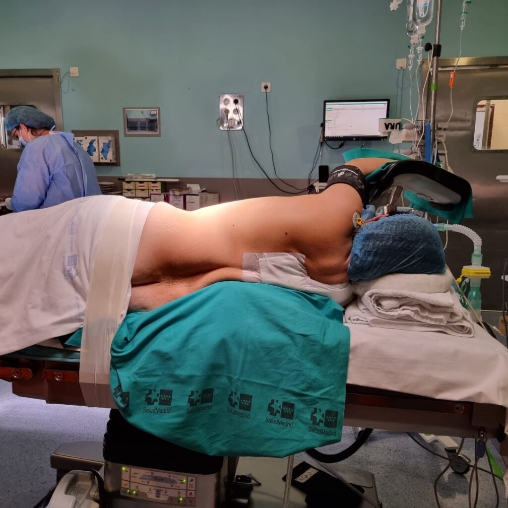 Posición quirúrgica para toracotomía posterolateral
